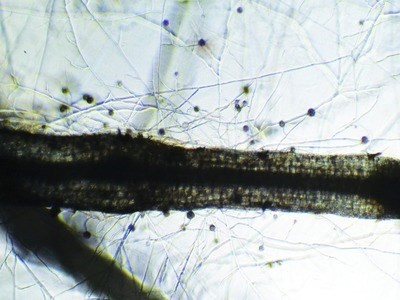 Mycorrhizae